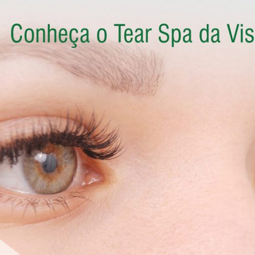 Tear Spa: nosso centro especializado em Disfunção Lacrimal